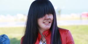 Yüzüne asit döken erkek arkadaşını affeden Berfin: “Bunu nasıl yapabildim”