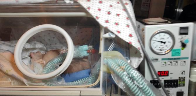 Suriyeli yapışık siyam ikizleri Ankara’ya getirildi