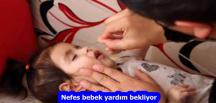 Nefes bebek yardım bekliyor