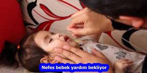 Nefes bebek yardım bekliyor