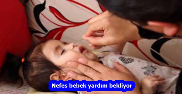 Nefes bebek yardım bekliyor