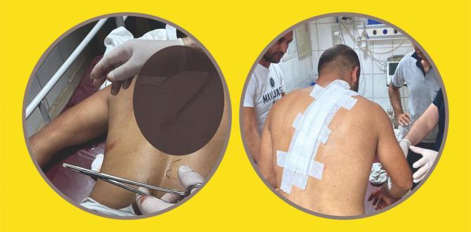 Samandağ’da belediye personeline bıçaklı saldırı